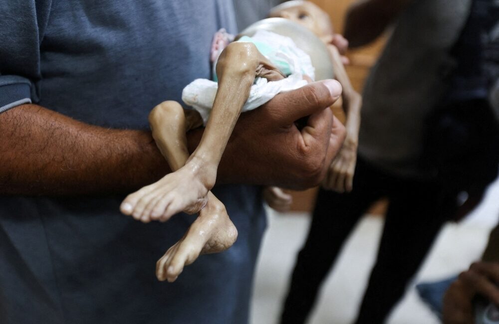 Hunger is Stealing Gaza’s Children A Human Tragedy That Could Be Stopped