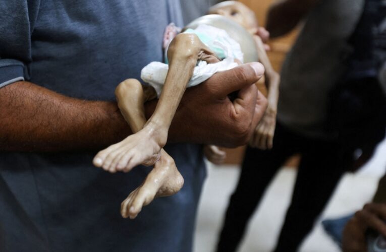 Hunger is Stealing Gaza’s Children A Human Tragedy That Could Be Stopped