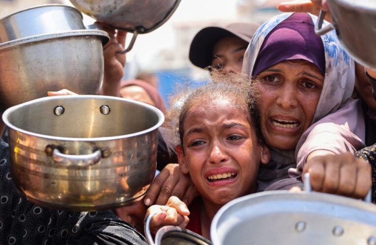 Amnesty International Alleges Israel is ‘Weaponising Hunger’ in Prolonged Gaza Crisis