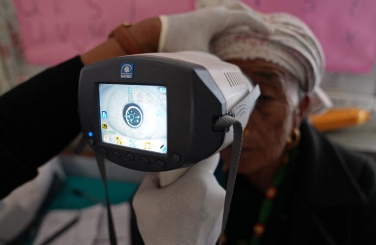 WHO: 94 Million People Need Cataract Surgery, But Access Remains Limited