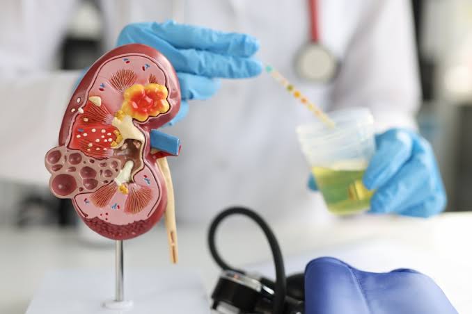 Parliament Panel Calls For Mandatory Kidney Tests From Age 20 A Major Push For Early Detection And Prevention